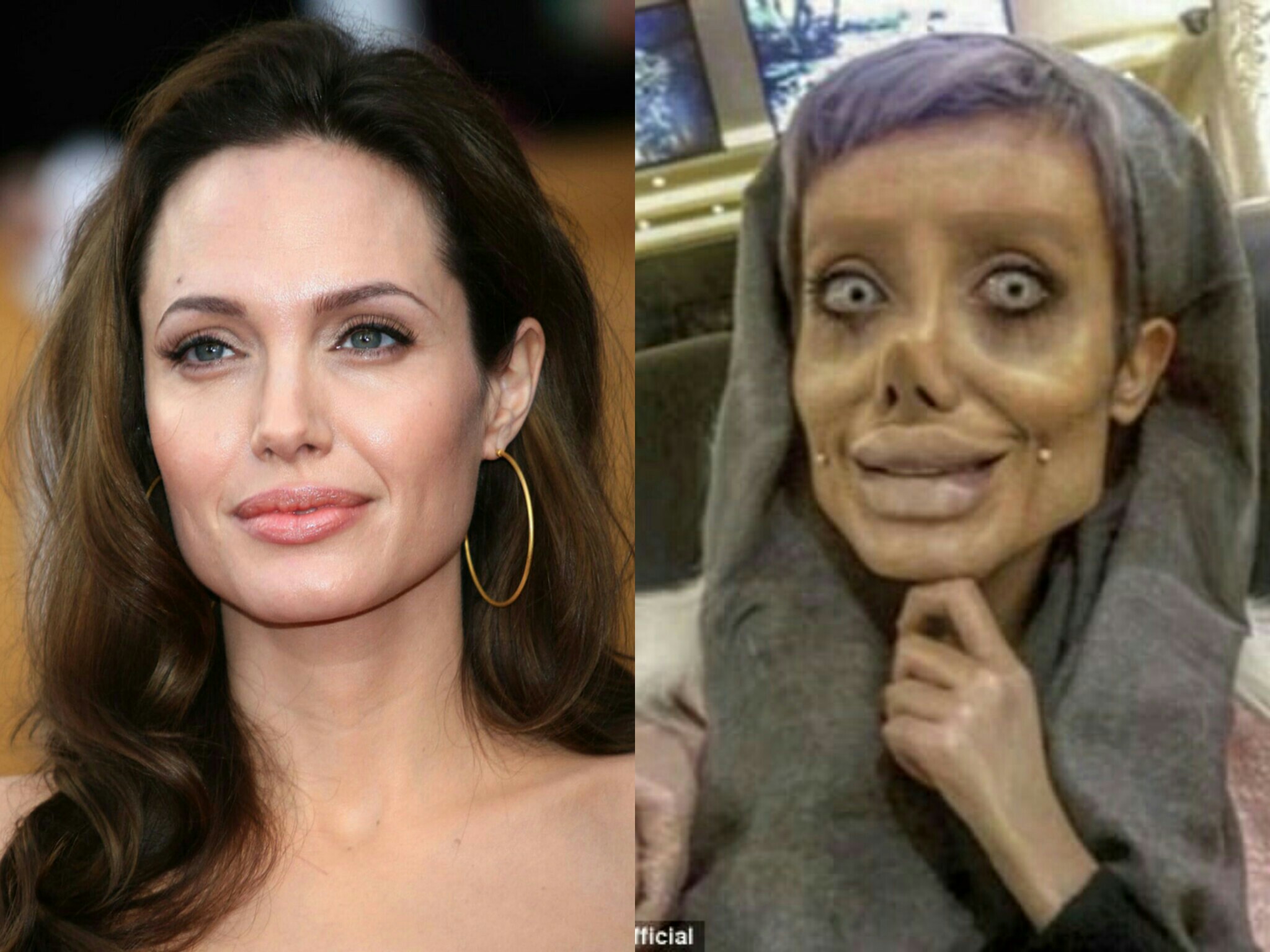 Menyeramkan Operasi Plastik Demi Terlihat Sama Seperti Angelina Jolie Gadis Asal Iran Ini Justru Seperti Zombie Manaberita