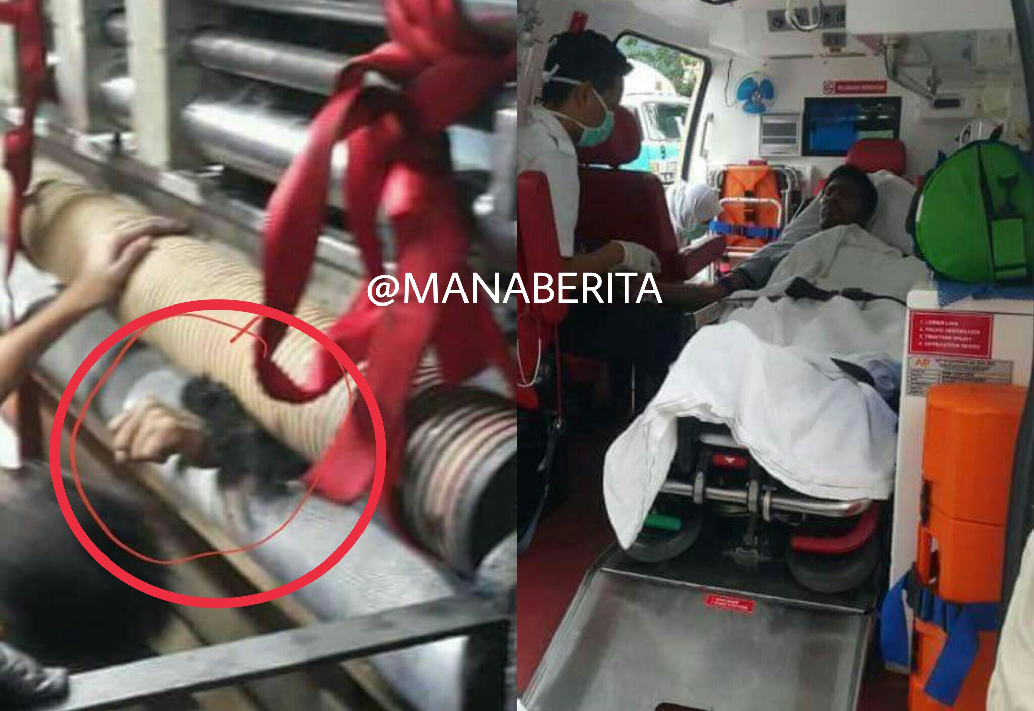 Bekerja di Pabrik, Tangan Pria ini Terjepit di Mesin 